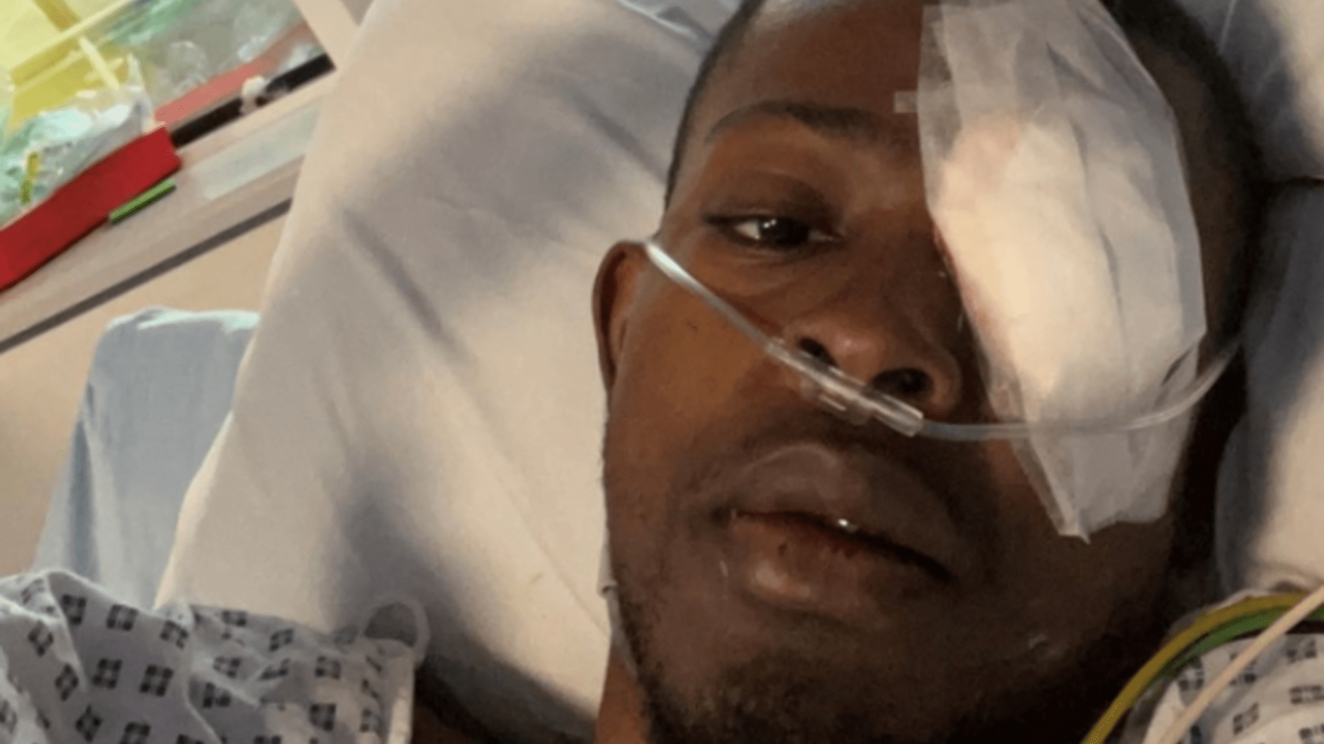 Fotos impactantes muestran que el ojo de un hombre “se cae de la cabeza”, pero fueron necesarios nueve viajes al hospital para finalmente obtener el diagnóstico