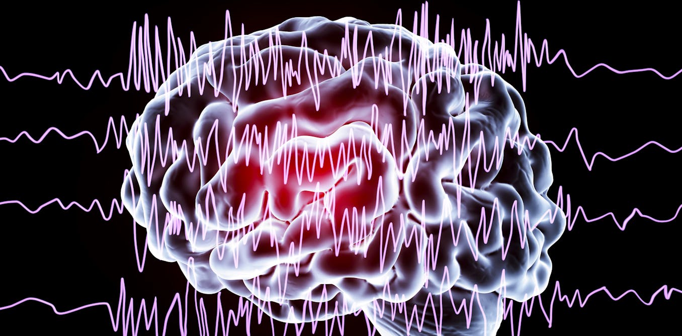 Un siglo después del descubrimiento del EEG, sigue siendo una herramienta essential para comprender el cerebro